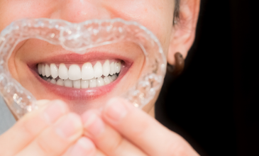 Smile Correction